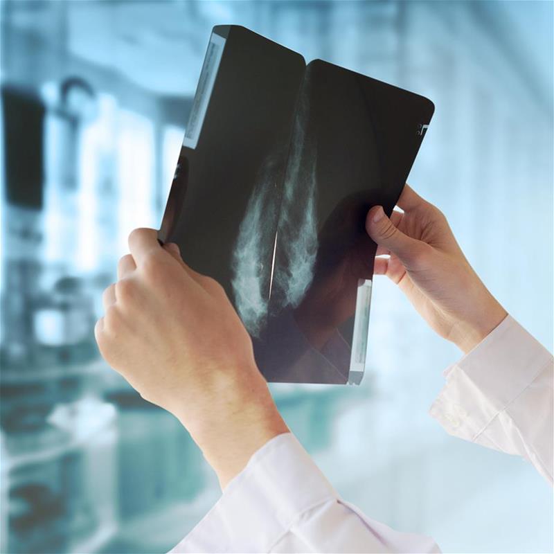 Health care professional viewing an x-ray
