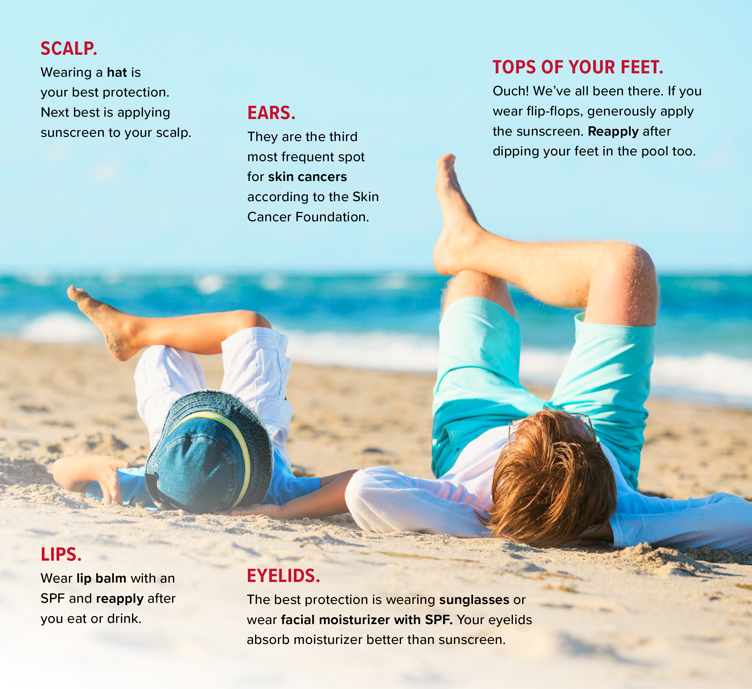 The scalp, ears, lips, eyelids, and tops of feet are five places to remember to put sunscreen